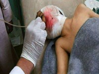 قطع اعضای بدن کودکان توسط سعودی ها
